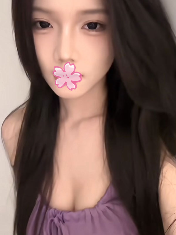 310